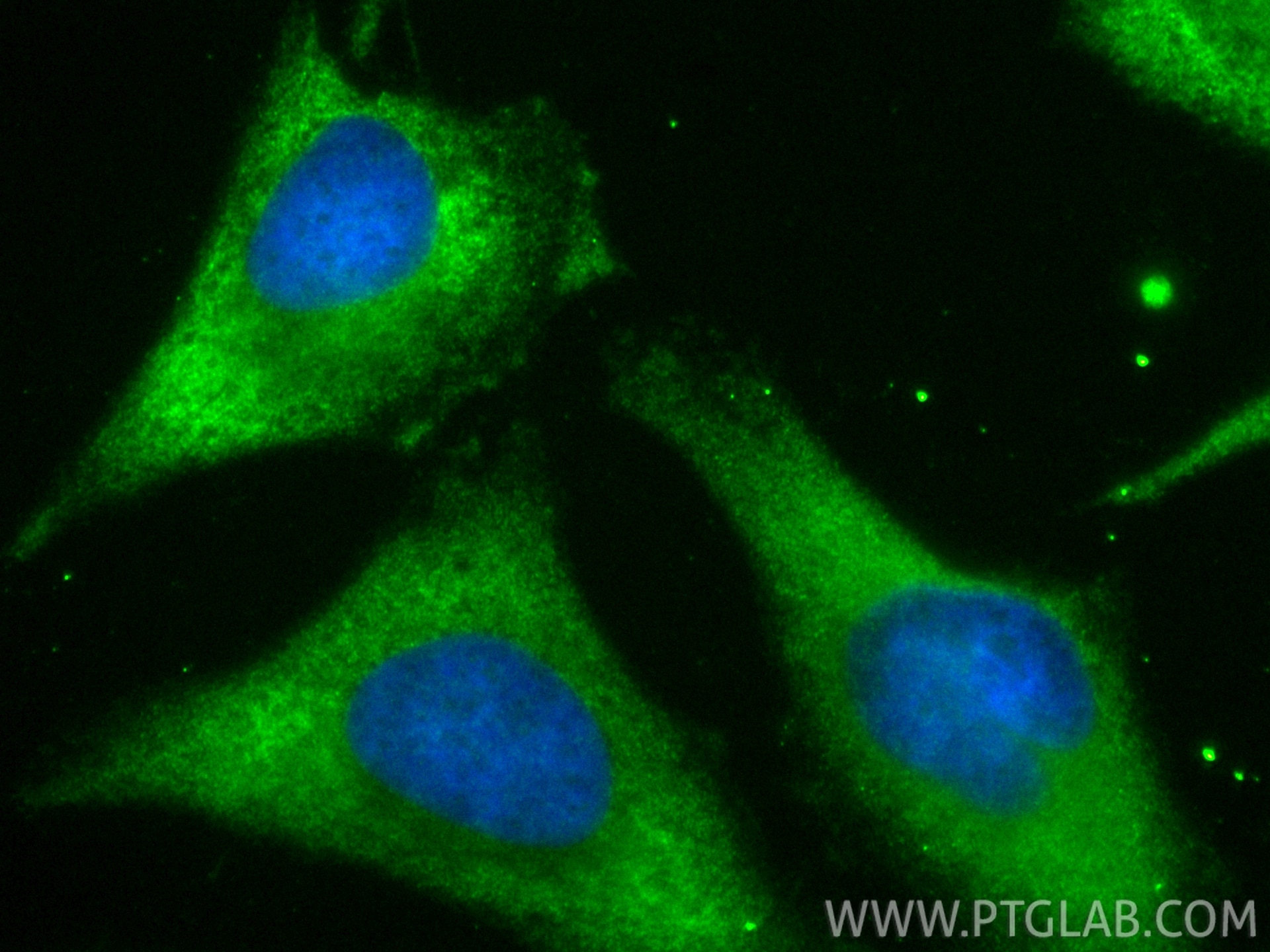 Immunofluorescent analysis of (-20°C Ethanol) fixed HeLa cells using CoraLite® Plus 488 mDia1 antibody (CL488-85708-2, Clone: 243001A5 ) at dilution of 1:200. Immunofluorescence (IF) / fluorescent staining of HeLa cells using CoraLite® Plus 488-conjugated mDia1 Recombinant mo (CL488-85708-2)