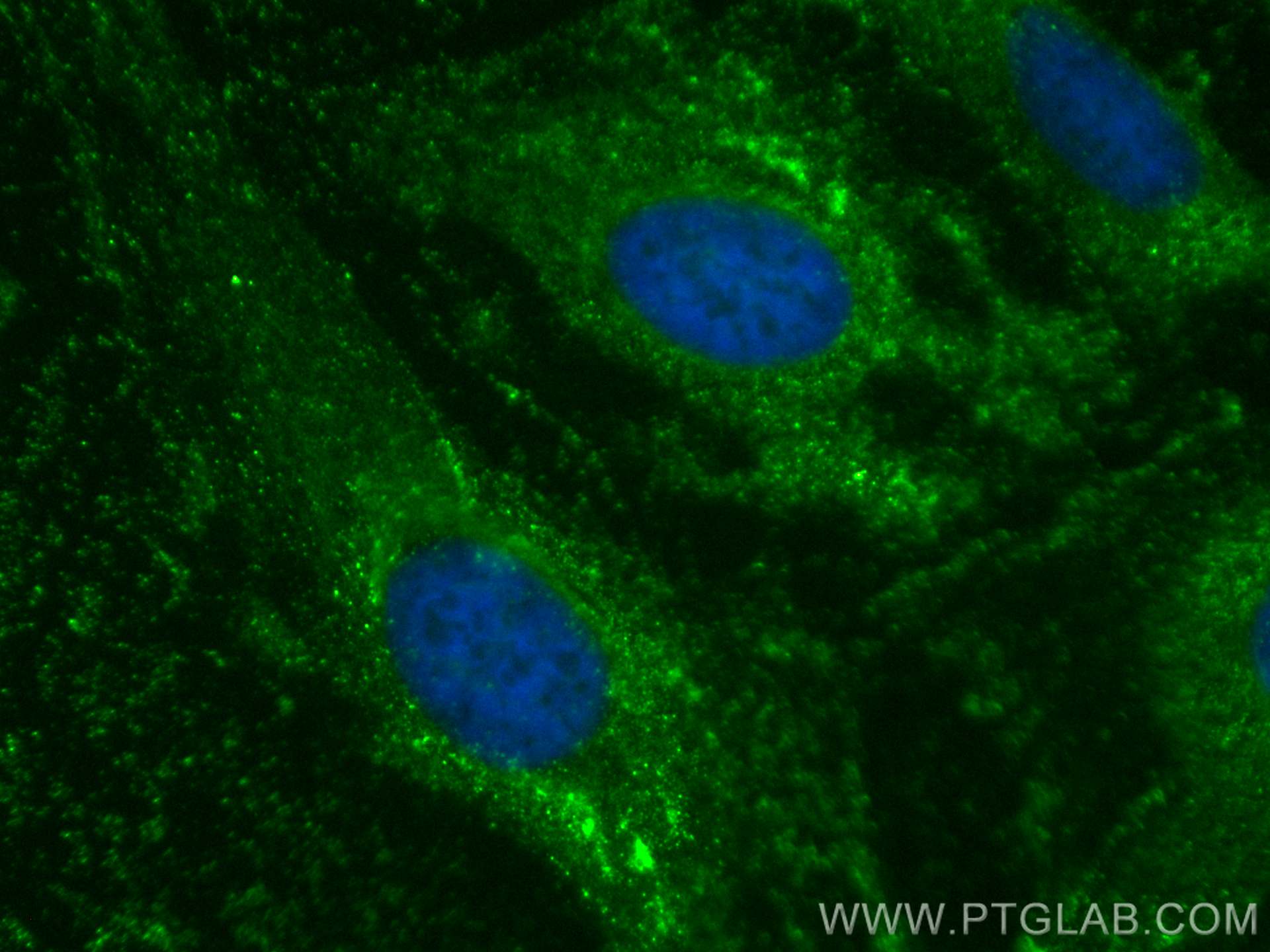 Immunofluorescence (IF) / fluorescent staining of HeLa cells using CoraLite® Plus 488-conjugated mTOR Polyclonal anti (CL488-28273)