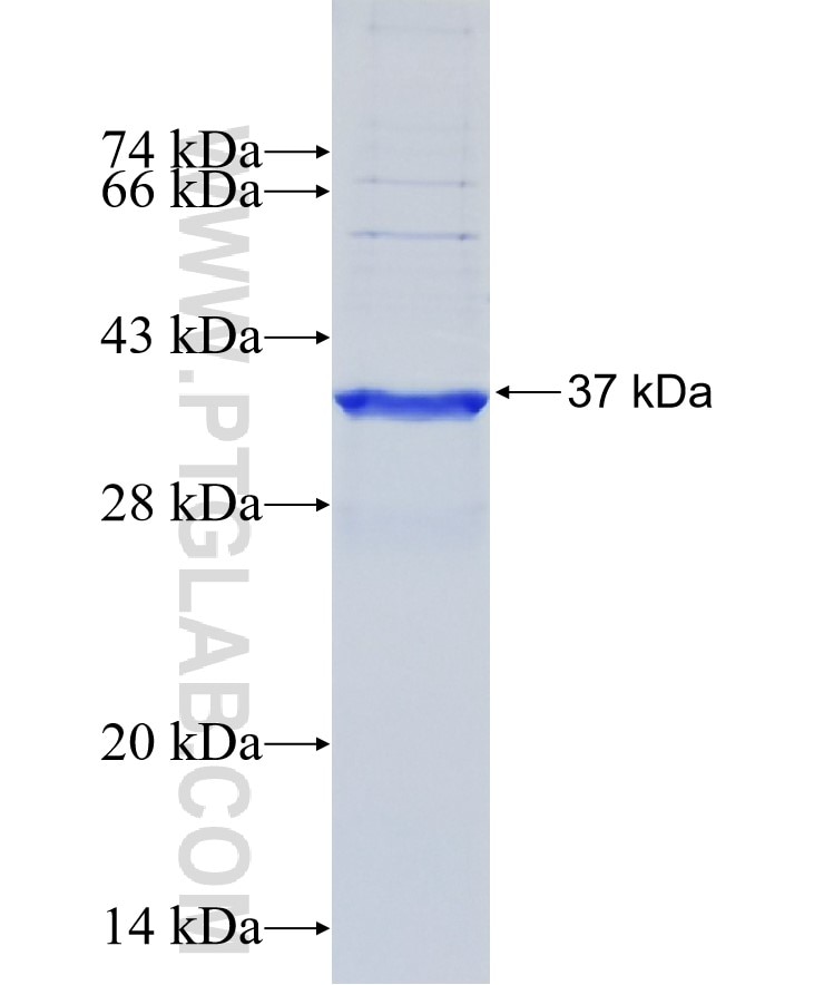 membrane glycoprotein fusion protein Ag30691 SDS-PAGE