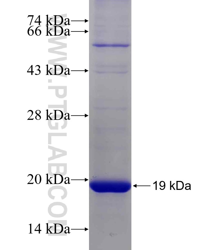 2019-nCOV membrane glycoprotein fusion protein Ag30692 SDS-PAGE