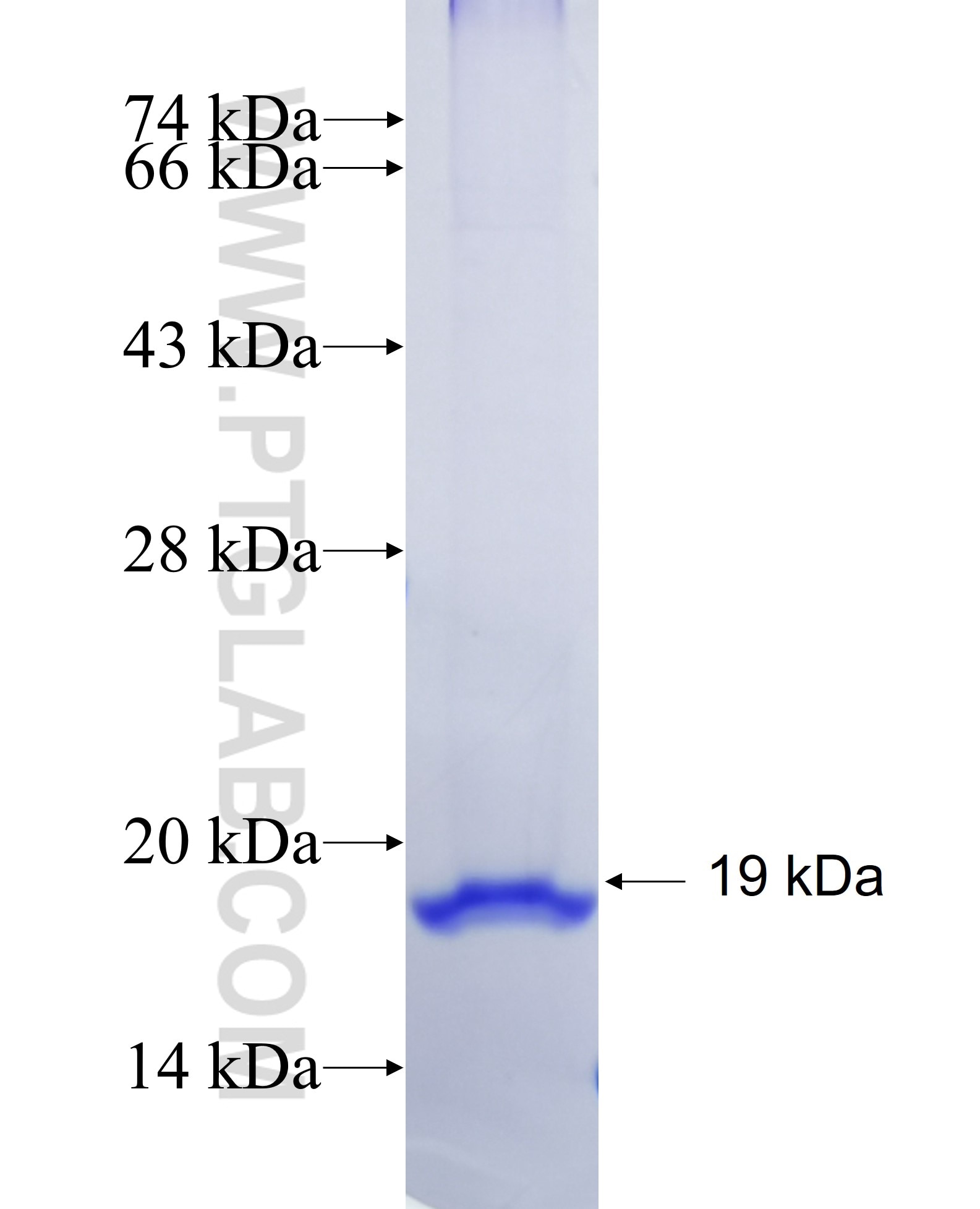 2019-nCOV membrane glycoprotein fusion protein Ag30692 SDS-PAGE