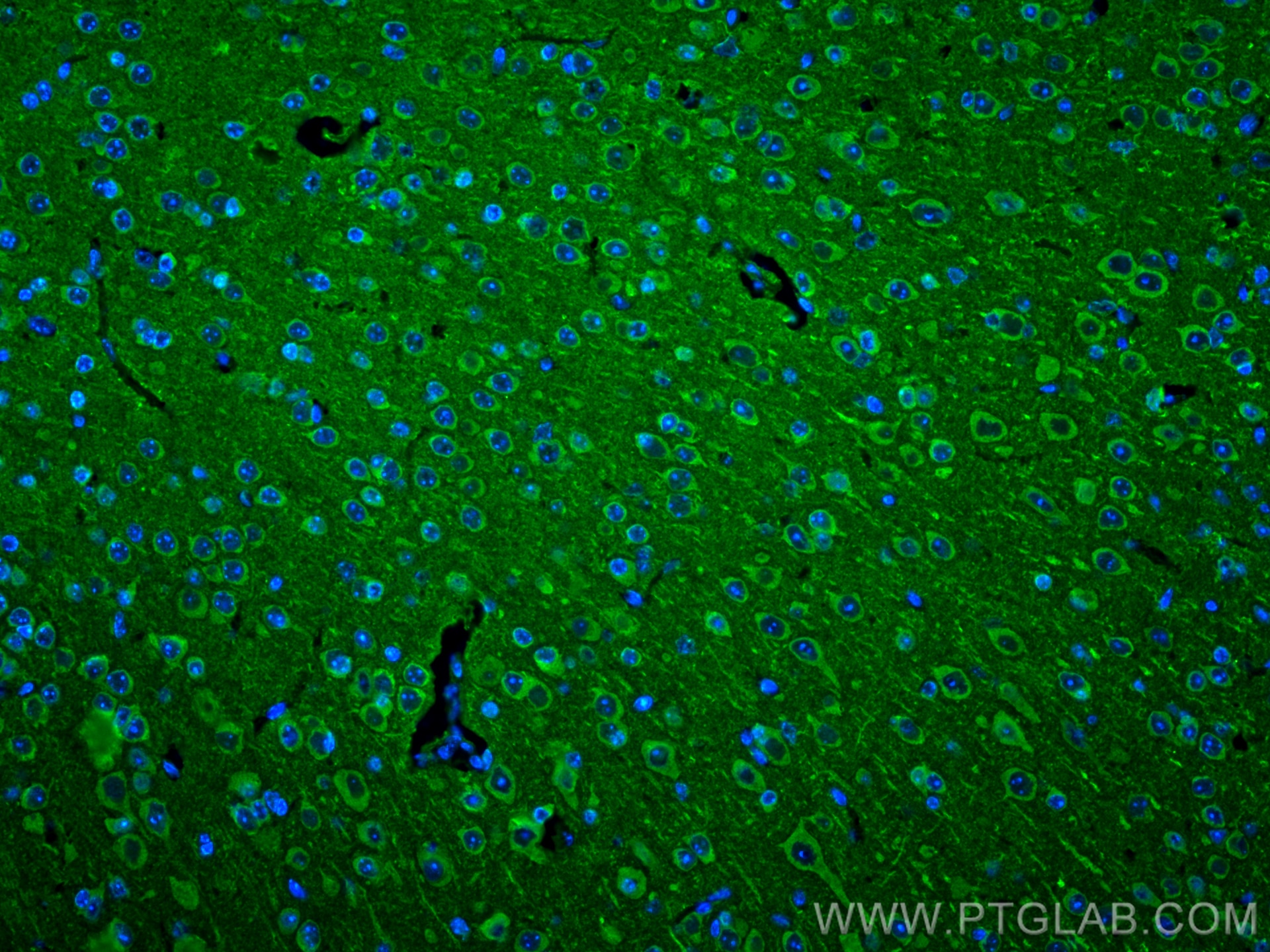 Immunofluorescence (IF) / fluorescent staining of mouse brain tissue using nNOS Polyclonal antibody (18984-1-AP)