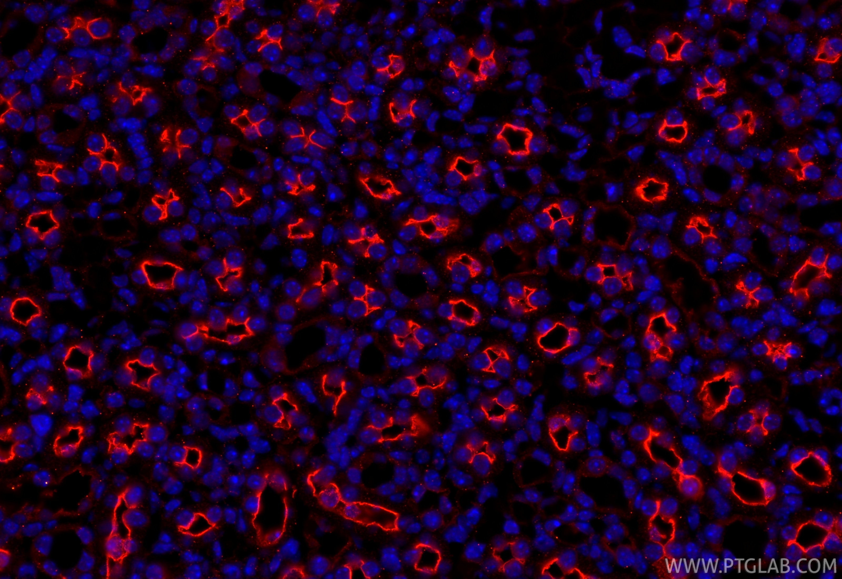 Immunofluorescence (IF) / fluorescent staining of mouse kidney tissue using nNOS Polyclonal antibody (18984-1-AP)
