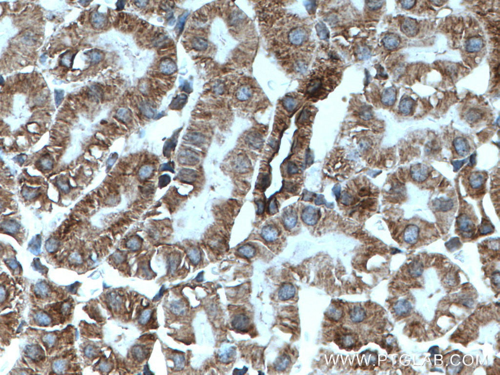 Immunohistochemistry (IHC) staining of mouse kidney tissue using nNOS Polyclonal antibody (18984-1-AP)