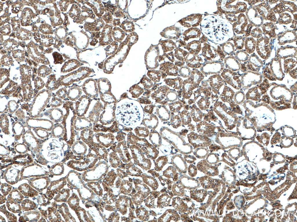 Immunohistochemistry (IHC) staining of mouse kidney tissue using nNOS Polyclonal antibody (18984-1-AP)