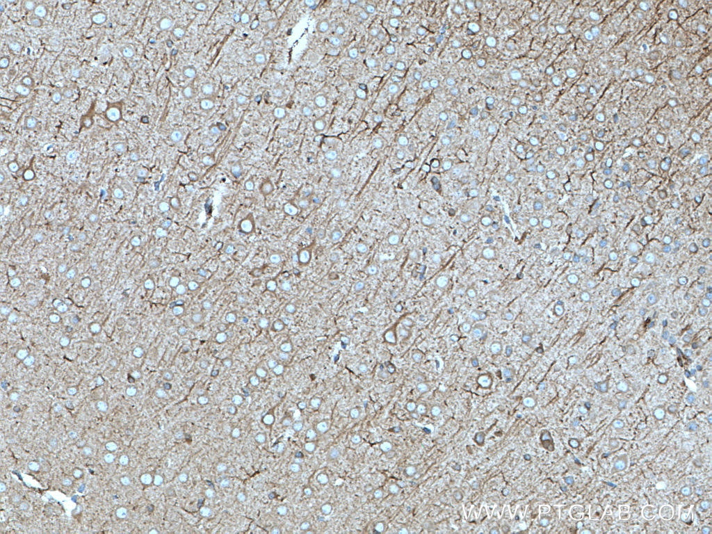 Immunohistochemistry (IHC) staining of mouse brain tissue using nNOS Polyclonal antibody (18984-1-AP)
