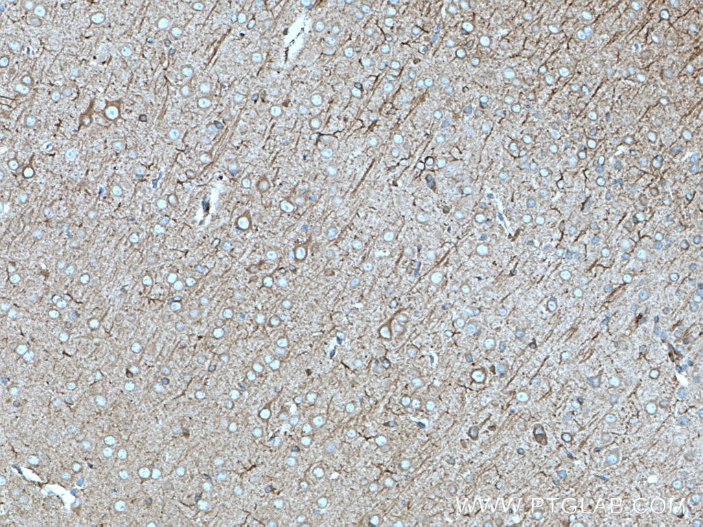 IHC staining of mouse brain using 18984-1-AP