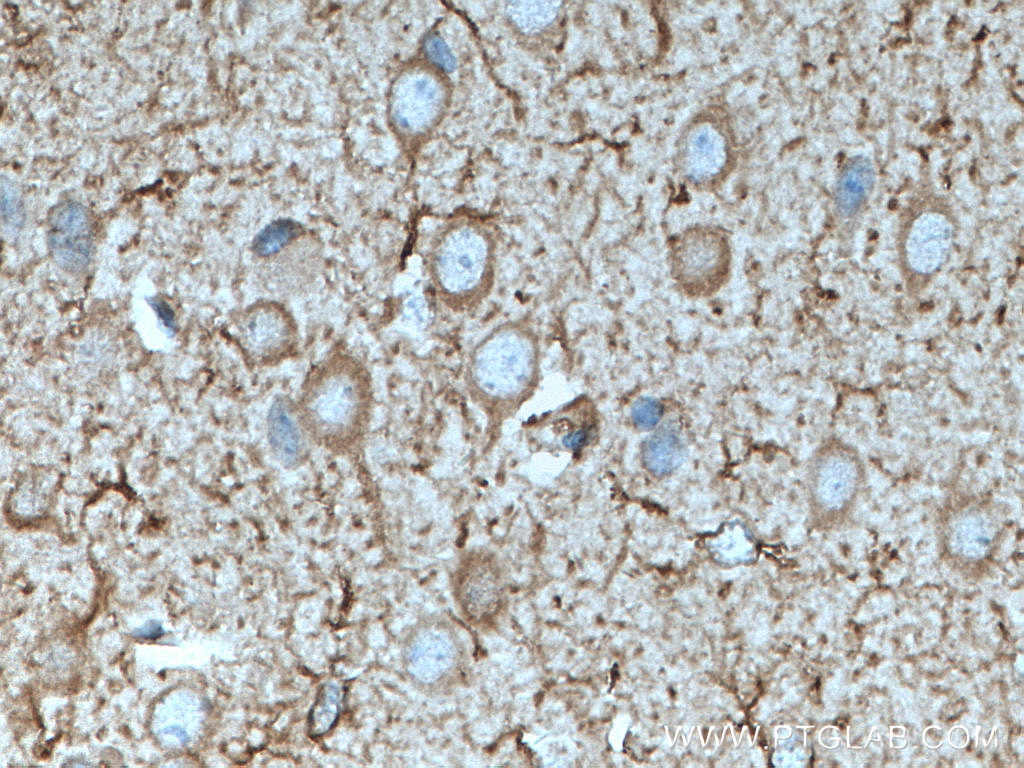 Immunohistochemistry (IHC) staining of mouse brain tissue using nNOS Polyclonal antibody (18984-1-AP)