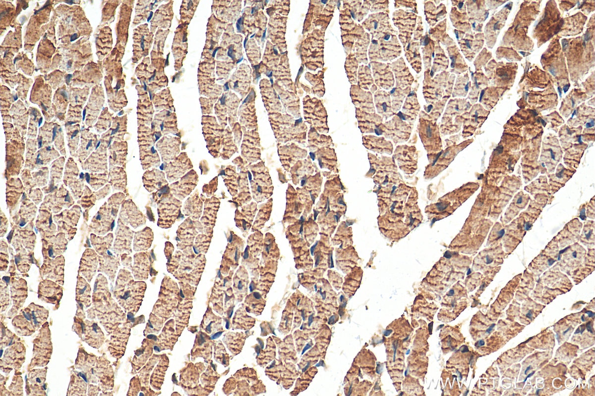 Immunohistochemistry (IHC) staining of mouse heart tissue using nNOS Polyclonal antibody (18984-1-AP)