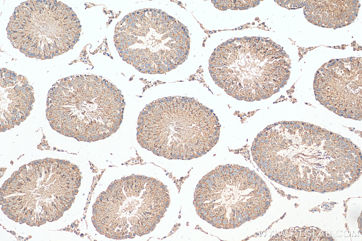 IHC staining of rat testis using 18984-1-AP