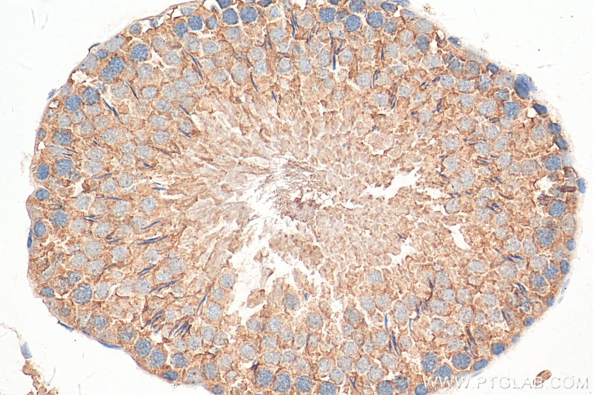 Immunohistochemistry (IHC) staining of rat testis tissue using nNOS Polyclonal antibody (18984-1-AP)