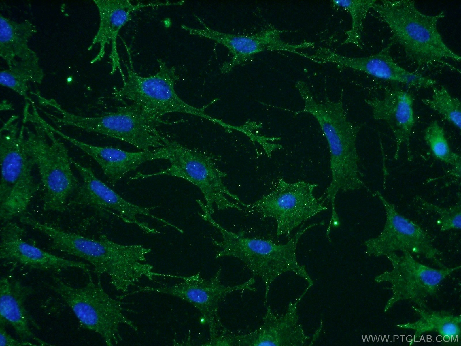 Immunofluorescence (IF) / fluorescent staining of NIH/3T3 cells using Nectin-4/PVRL4 Polyclonal antibody (21903-1-AP)