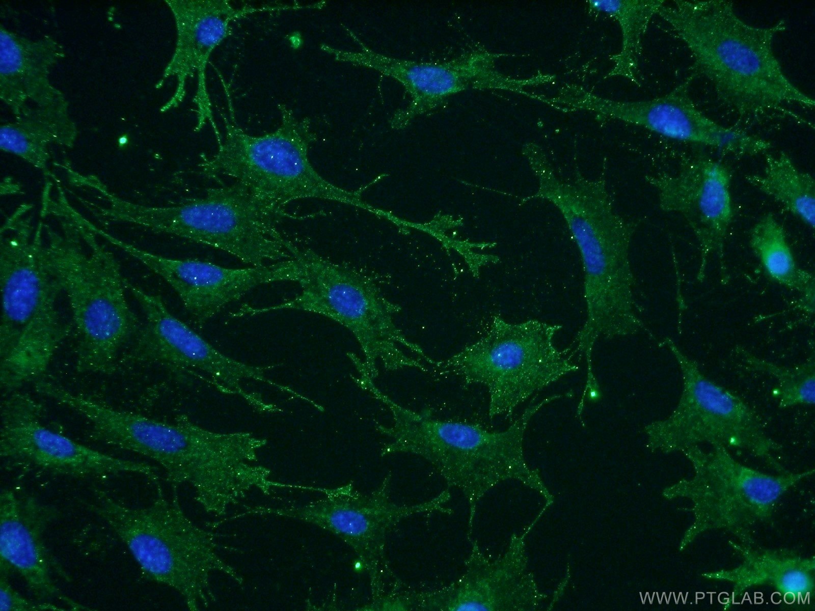 Nectin-4/PVRL4