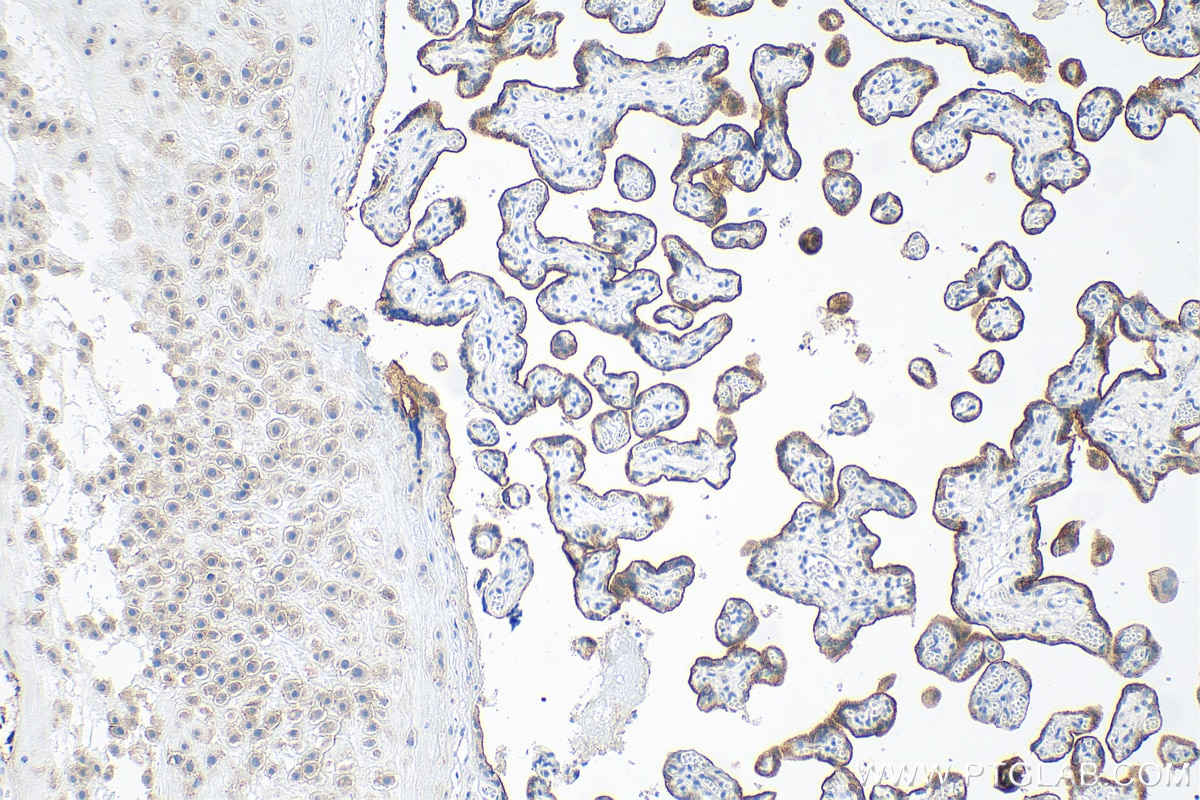 Immunohistochemistry (IHC) staining of human placenta tissue using Nectin-4/PVRL4 Polyclonal antibody (21903-1-AP)