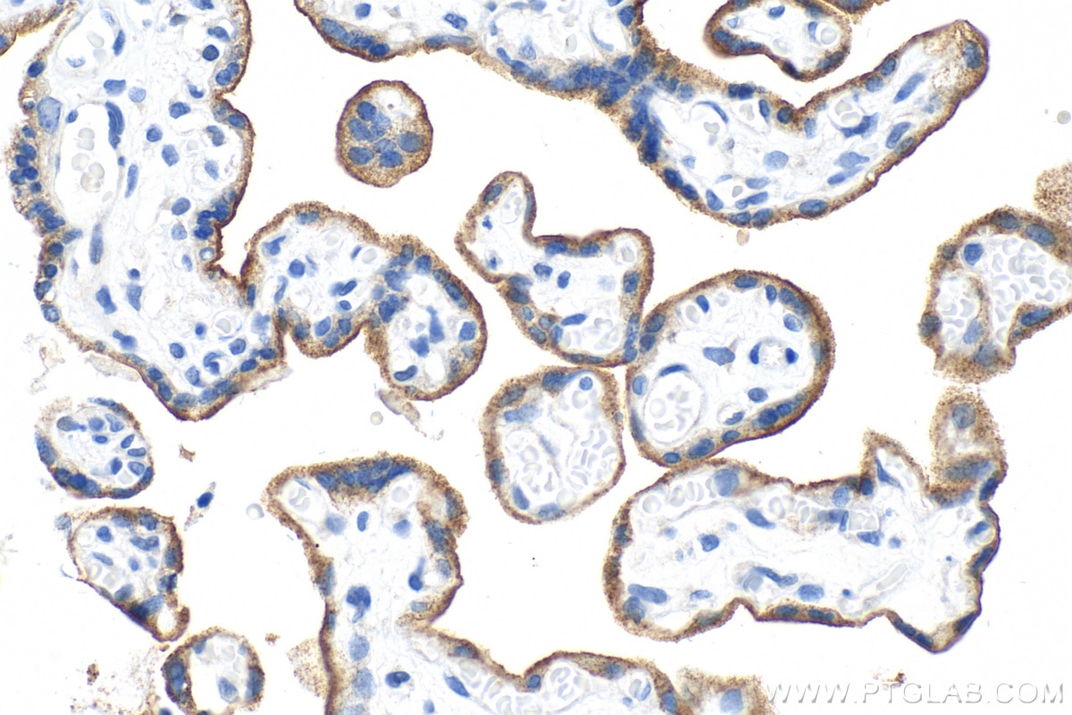 Immunohistochemistry (IHC) staining of human placenta tissue using Nectin-4/PVRL4 Polyclonal antibody (21903-1-AP)