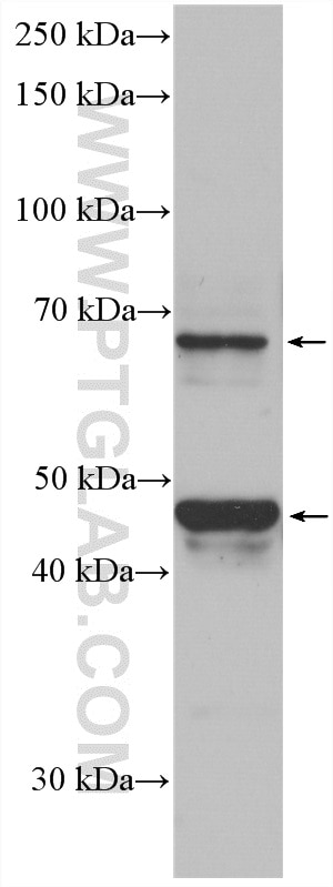 Western Blot (WB) analysis of MCF-7 cells using Nectin-4/PVRL4 Polyclonal antibody (21903-1-AP)