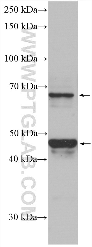 Western Blot (WB) analysis of MCF-7 cells using Nectin-4/PVRL4 Polyclonal antibody (21903-1-AP)