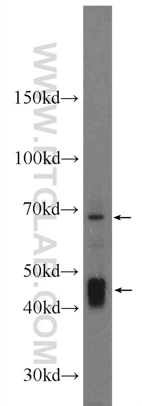 Western Blot (WB) analysis of HeLa cells using Nectin-4/PVRL4 Polyclonal antibody (21903-1-AP)