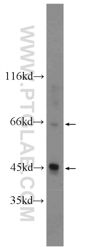 Western Blot (WB) analysis of A2780 cells using Nectin-4/PVRL4 Polyclonal antibody (21903-1-AP)