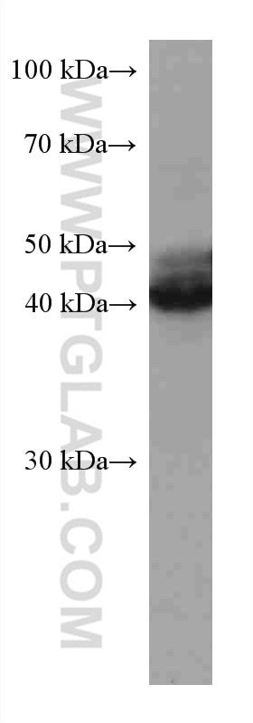 Western Blot (WB) analysis of A431 cells using Nectin-4/PVRL4 Monoclonal antibody (67721-1-Ig)