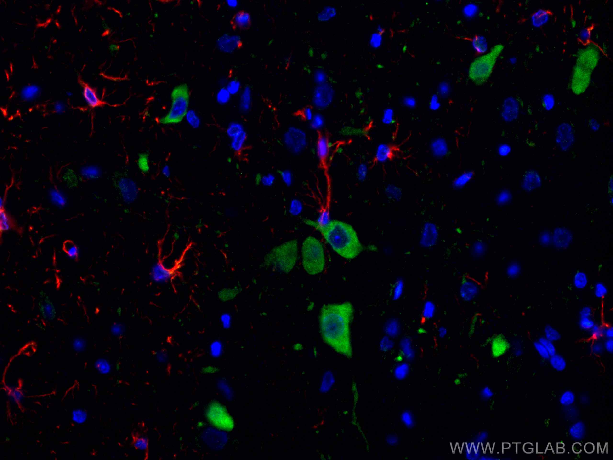 Immunofluorescence (IF) / fluorescent staining of rat brain tissue using Nestin Polyclonal antibody (29285-1-AP)