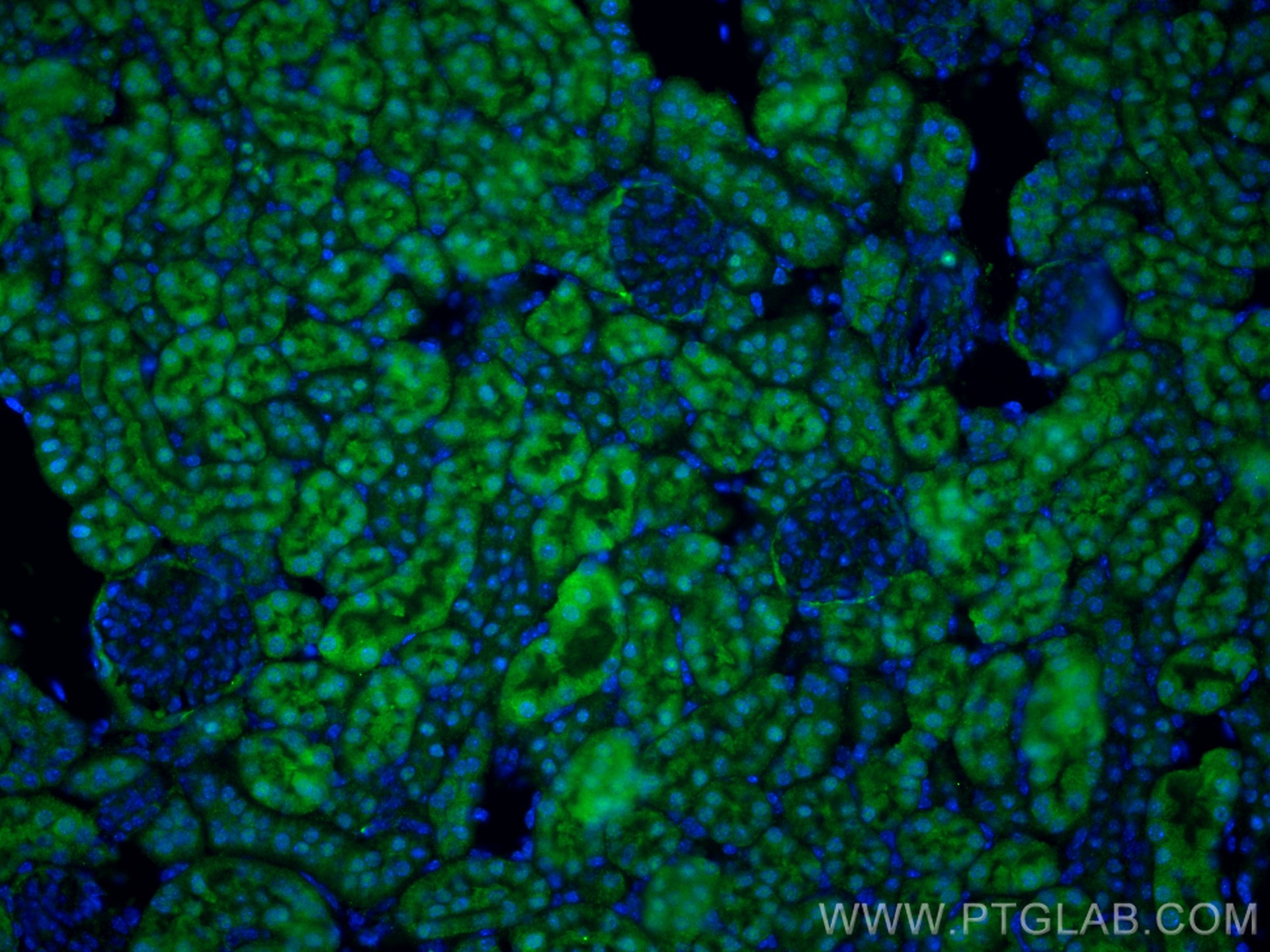Immunofluorescence (IF) / fluorescent staining of mouse kidney tissue using Nestin Polyclonal antibody (29285-1-AP)