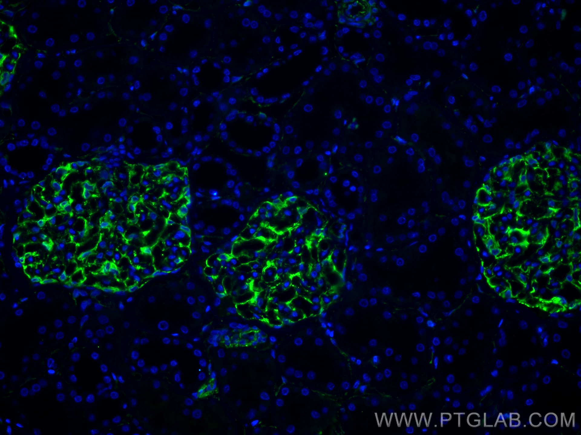 Immunofluorescence (IF) / fluorescent staining of human kidney tissue using Nestin Polyclonal antibody (29285-1-AP)
