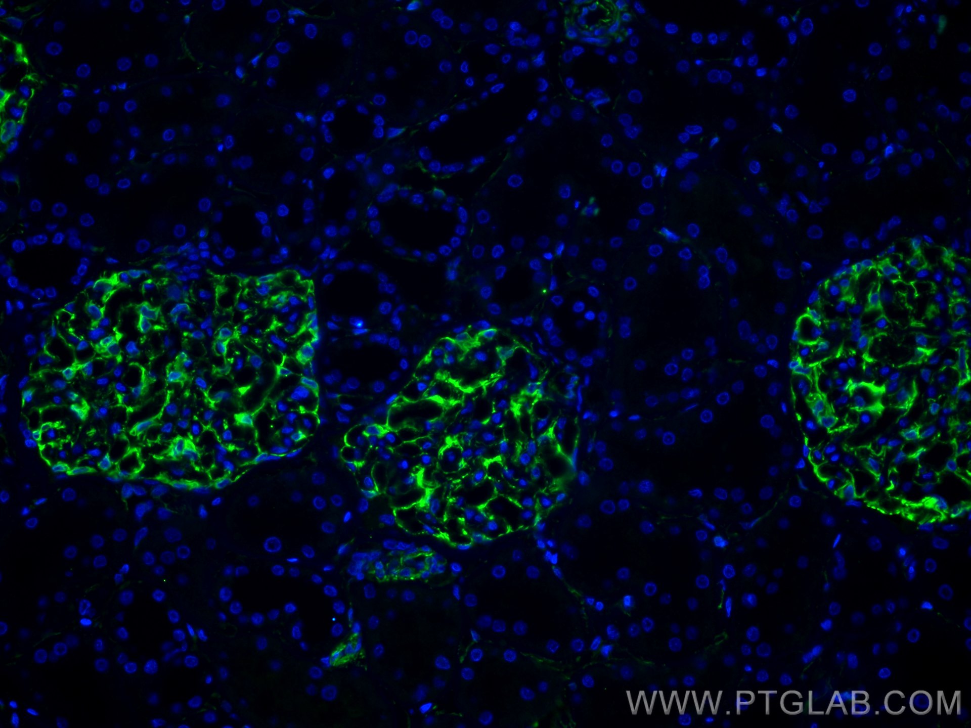 IF Staining of human kidney using 29285-1-AP