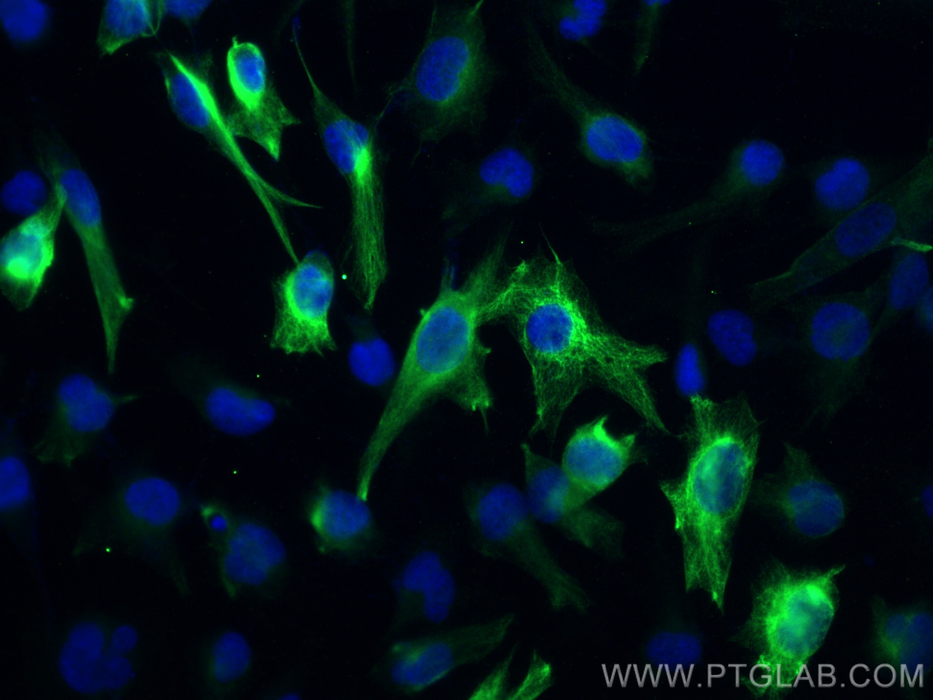 Immunofluorescence (IF) / fluorescent staining of U-251 cells using Nestin Polyclonal antibody (29285-1-AP)