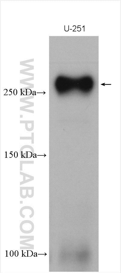 Western Blot (WB) analysis of various lysates using Nestin Polyclonal antibody (29285-1-AP)