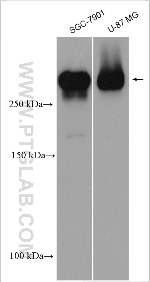 Western Blot (WB) analysis of various lysates using Nestin Polyclonal antibody (29285-1-AP)