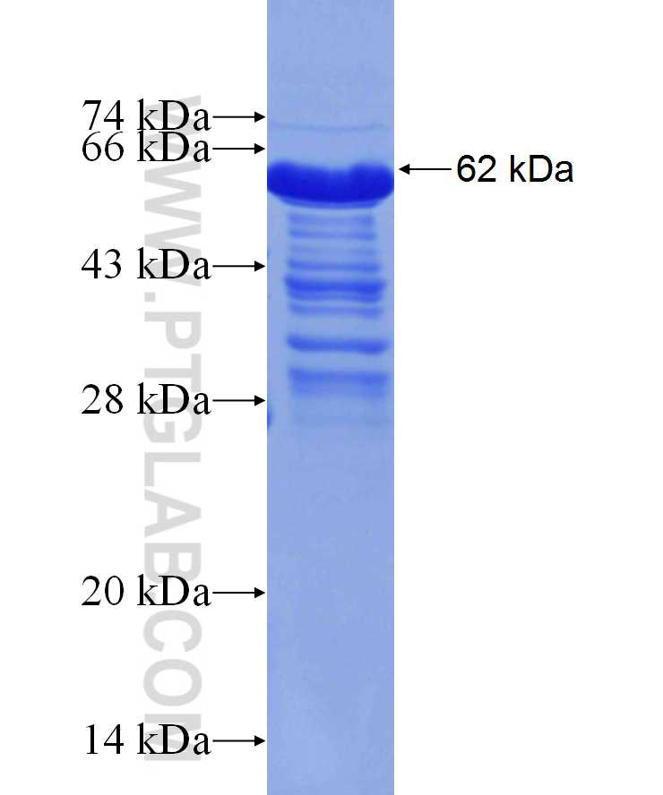 nestin fusion protein Ag29865 SDS-PAGE