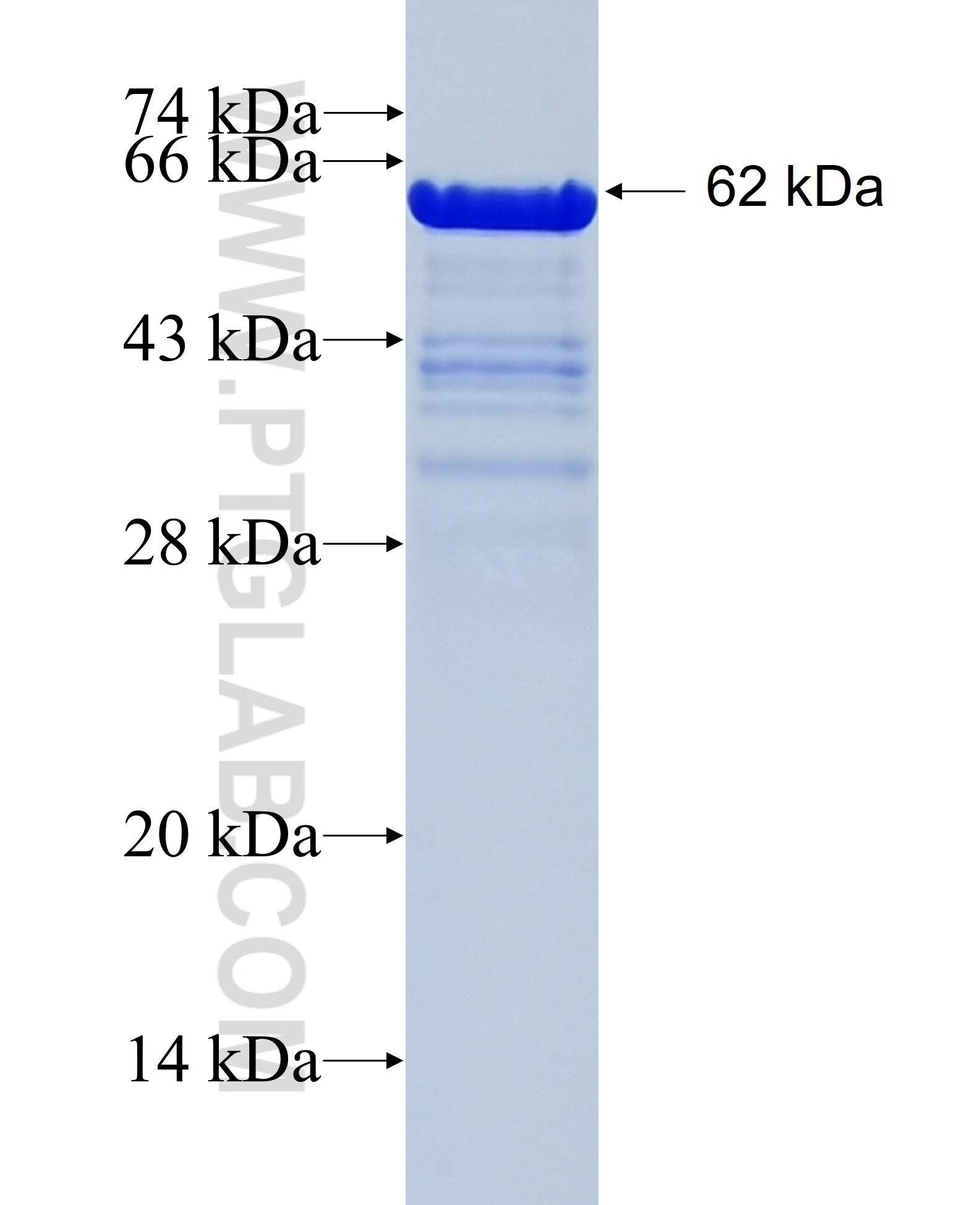 nestin fusion protein Ag29865 SDS-PAGE