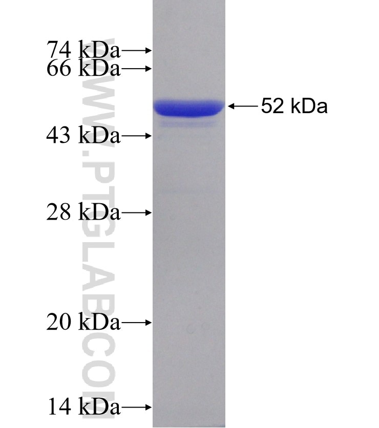 2019-nCOV nucleocapsid phosphoprotein fusion protein Ag30676 SDS-PAGE