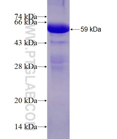 p115, USO1 fusion protein Ag4431 SDS-PAGE