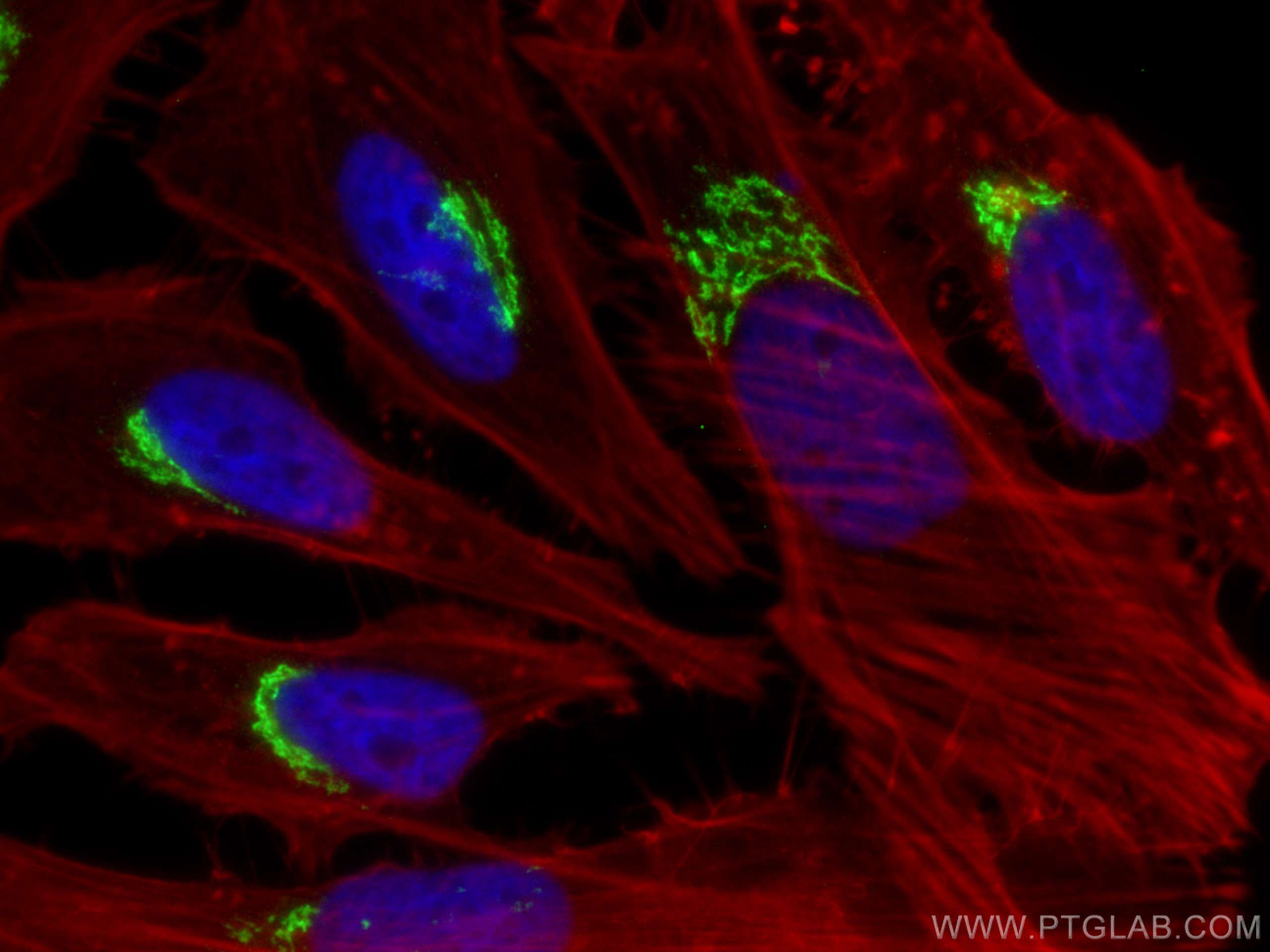 Immunofluorescence (IF) / fluorescent staining of HeLa cells using p115, USO1 Monoclonal antibody (68100-1-Ig)