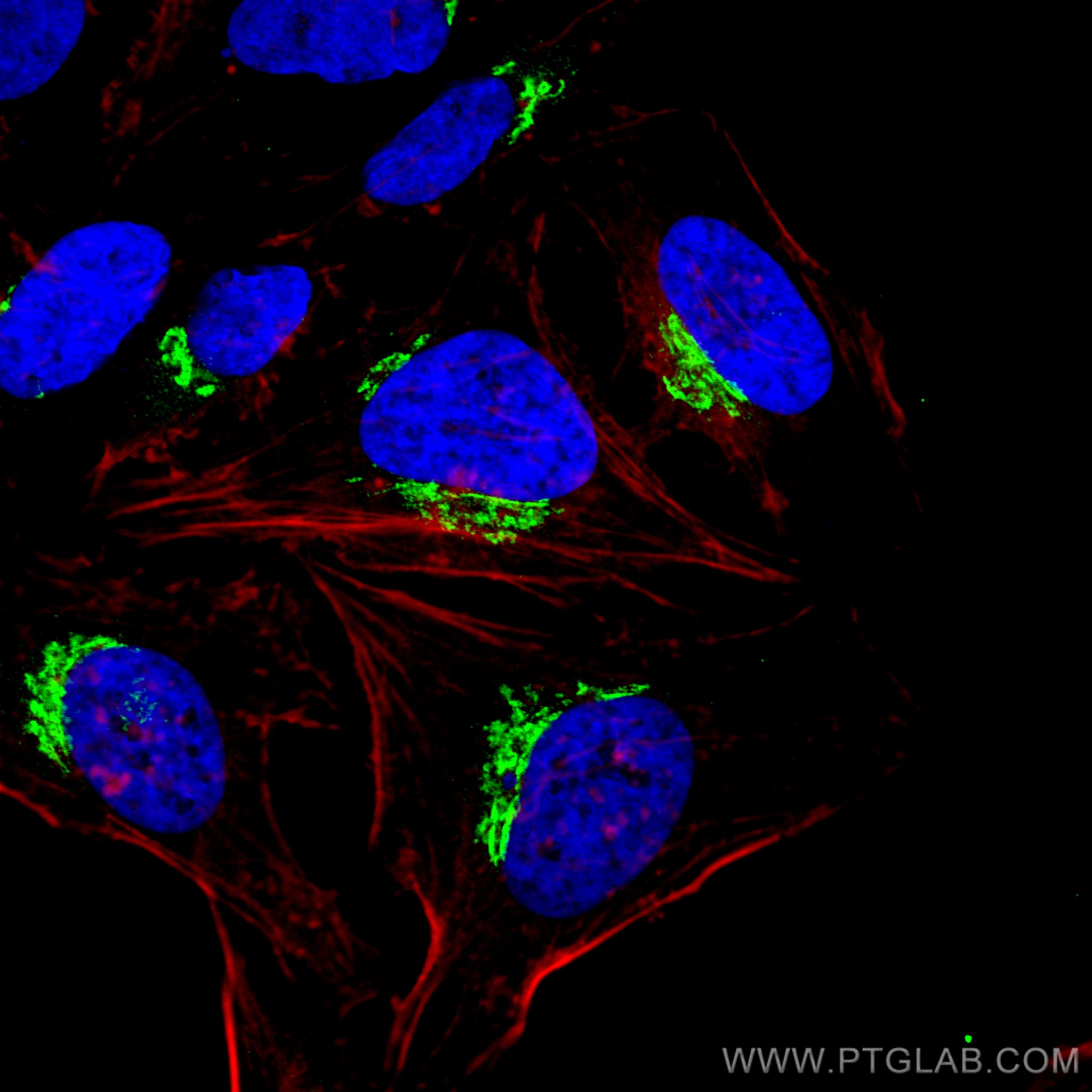 Immunofluorescence (IF) / fluorescent staining of HeLa cells using p115, USO1 Monoclonal antibody (68100-1-Ig)
