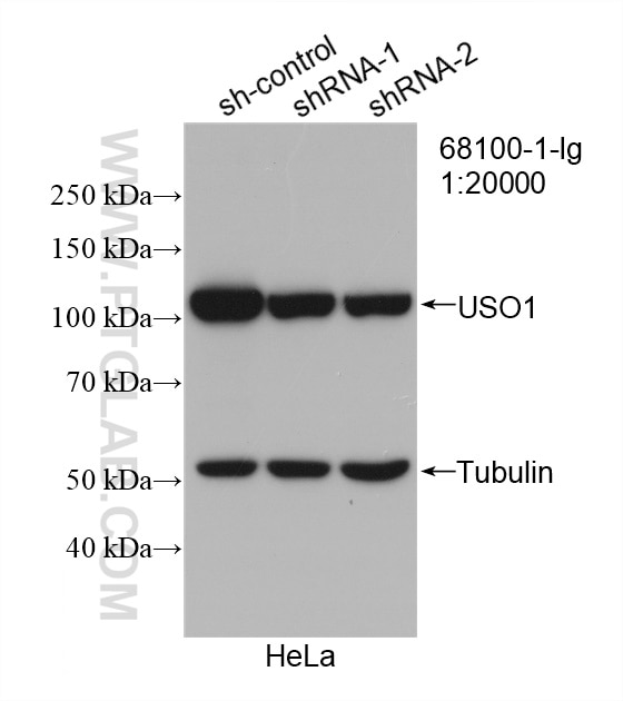 Western Blot (WB) analysis of HeLa cells using p115, USO1 Monoclonal antibody (68100-1-Ig)