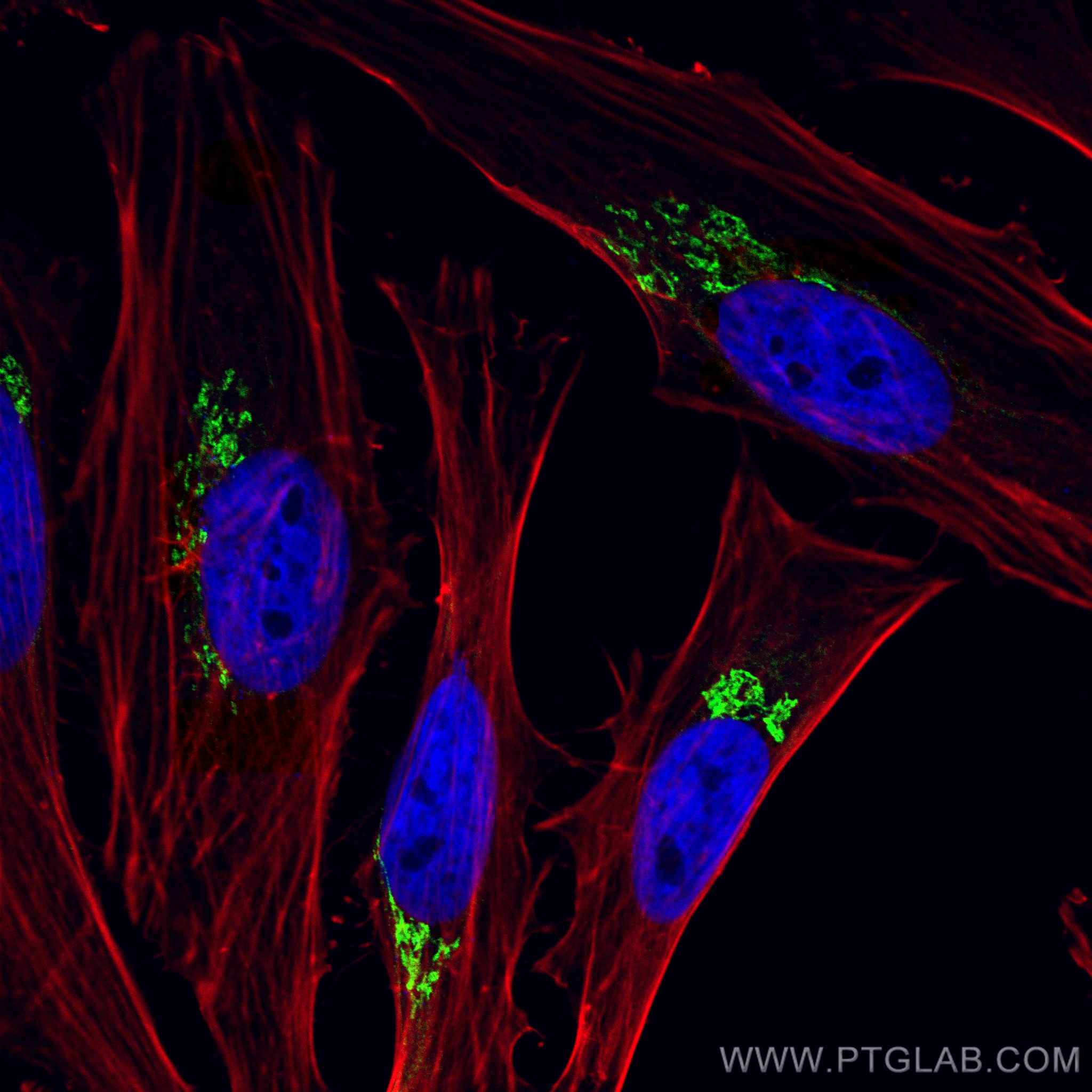 Immunofluorescence (IF) / fluorescent staining of HeLa cells using CoraLite® Plus 488-conjugated p115, USO1 Polyclona (CL488-13509)