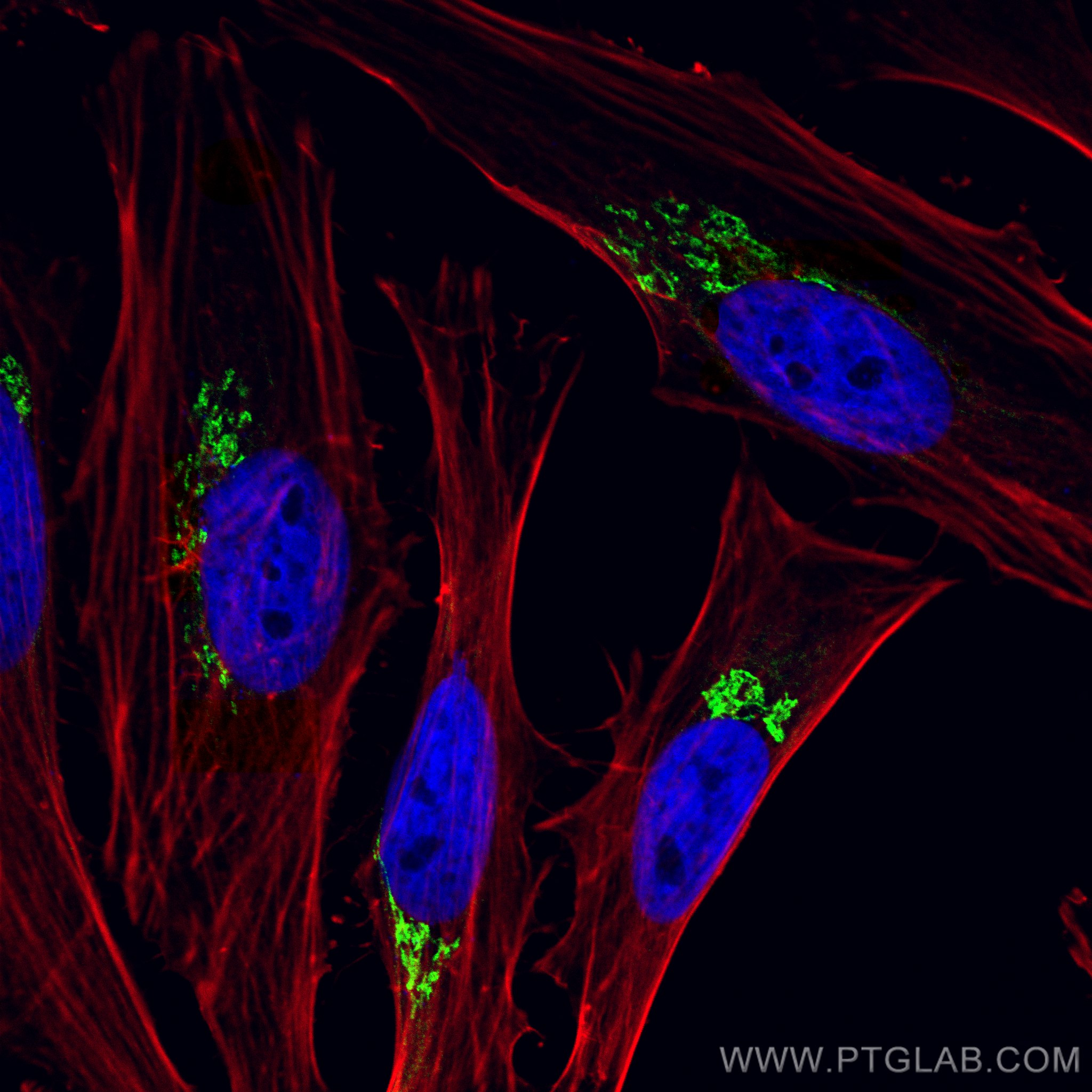 IF Staining of HeLa using CL488-13509