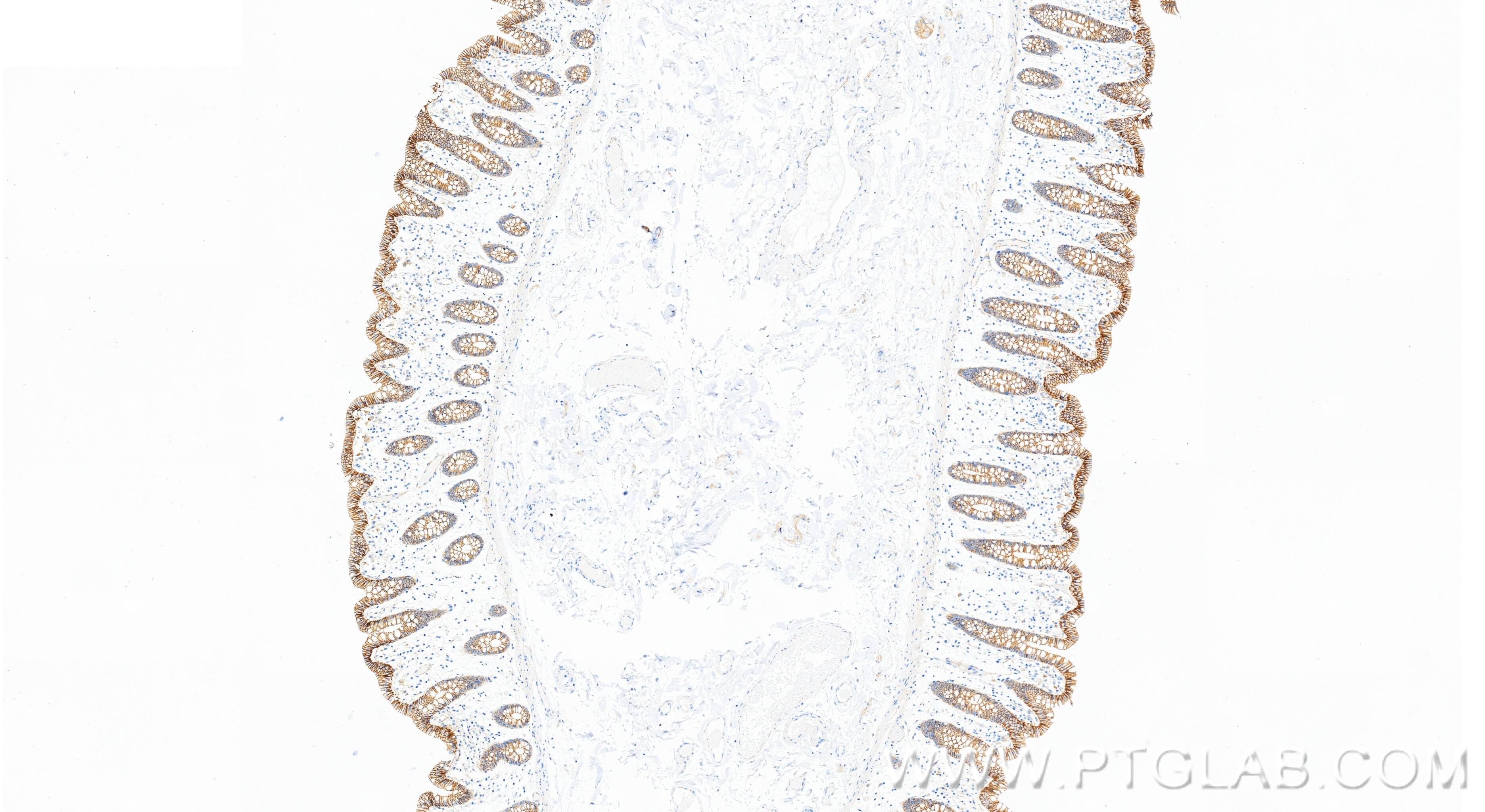 IHC staining of human colon using 88083-1-RR Immunohistochemistry (IHC) staining of human colon tissue using p120 Catenin Recombinant monoclonal antibody (88083-1-RR)
