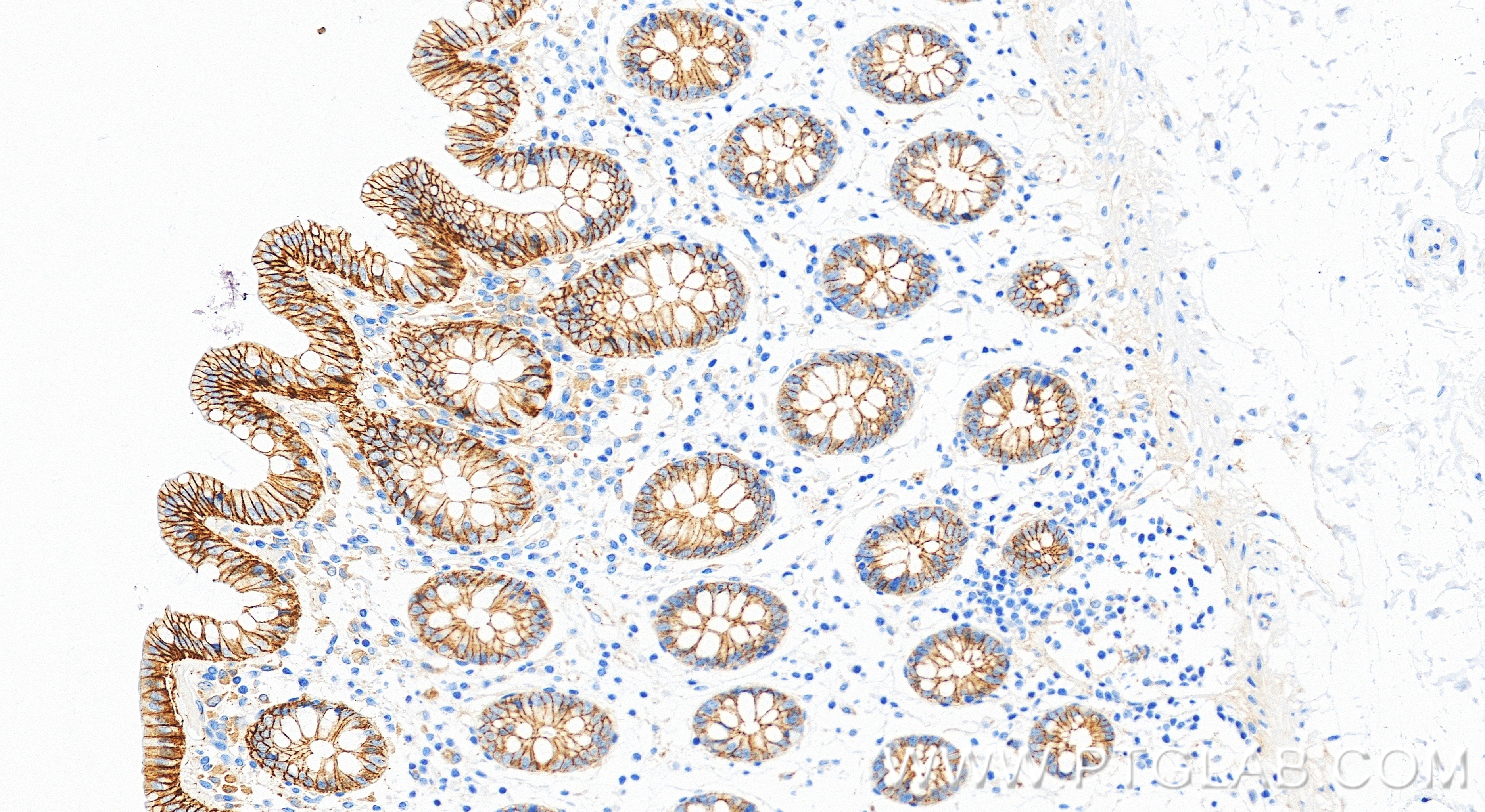IHC staining of human colon using 88083-1-RR Immunohistochemistry (IHC) staining of human colon tissue using p120 Catenin Recombinant monoclonal antibody (88083-1-RR)