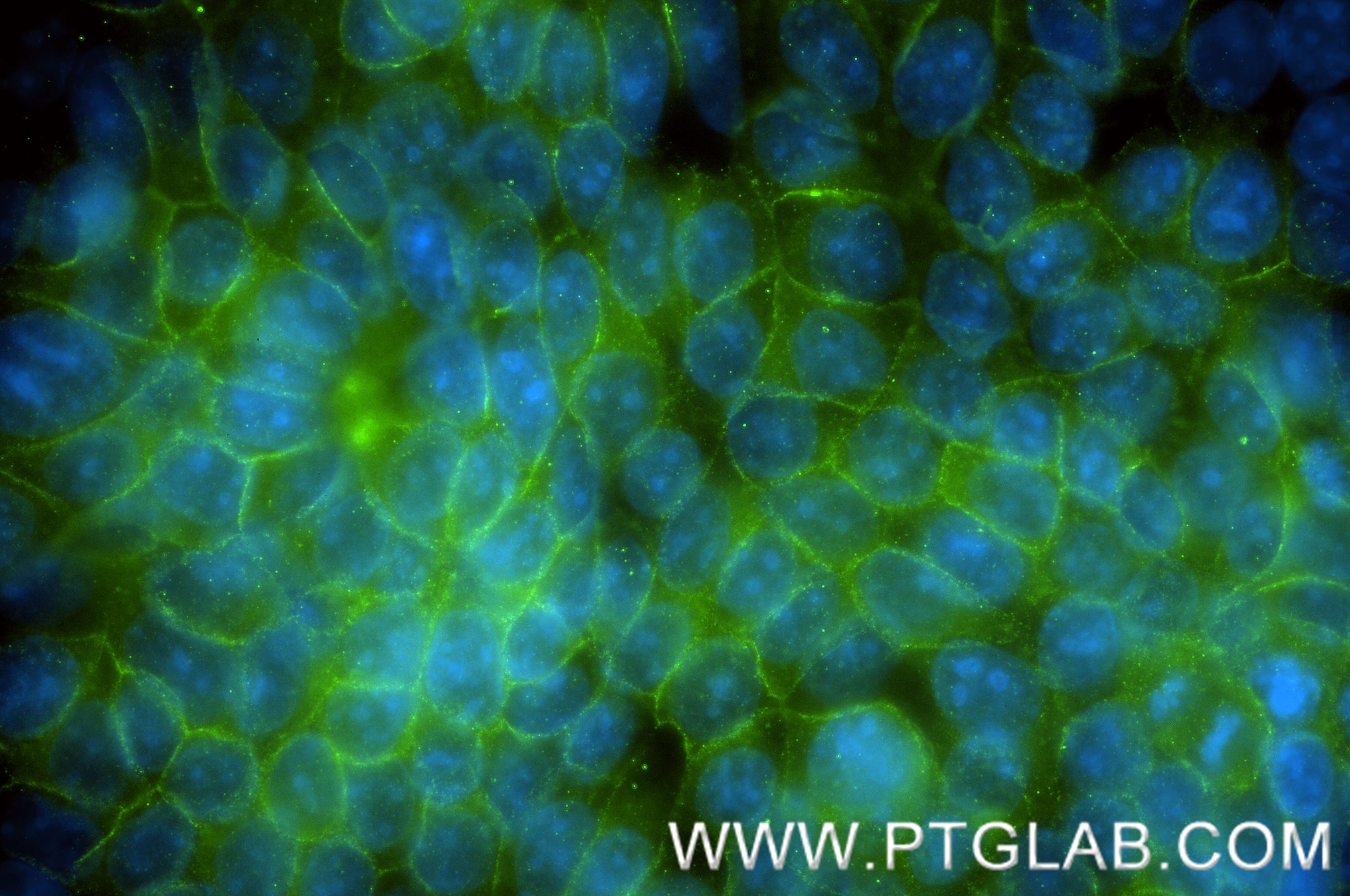 IF Staining of MCF-7 using 88083-1-RR (same clone as 88083-1-PBS) Immunofluorescence (IF) / fluorescent staining of MCF-7 cells using p120 Catenin Recombinant monoclonal antibody (88083-1-RR)