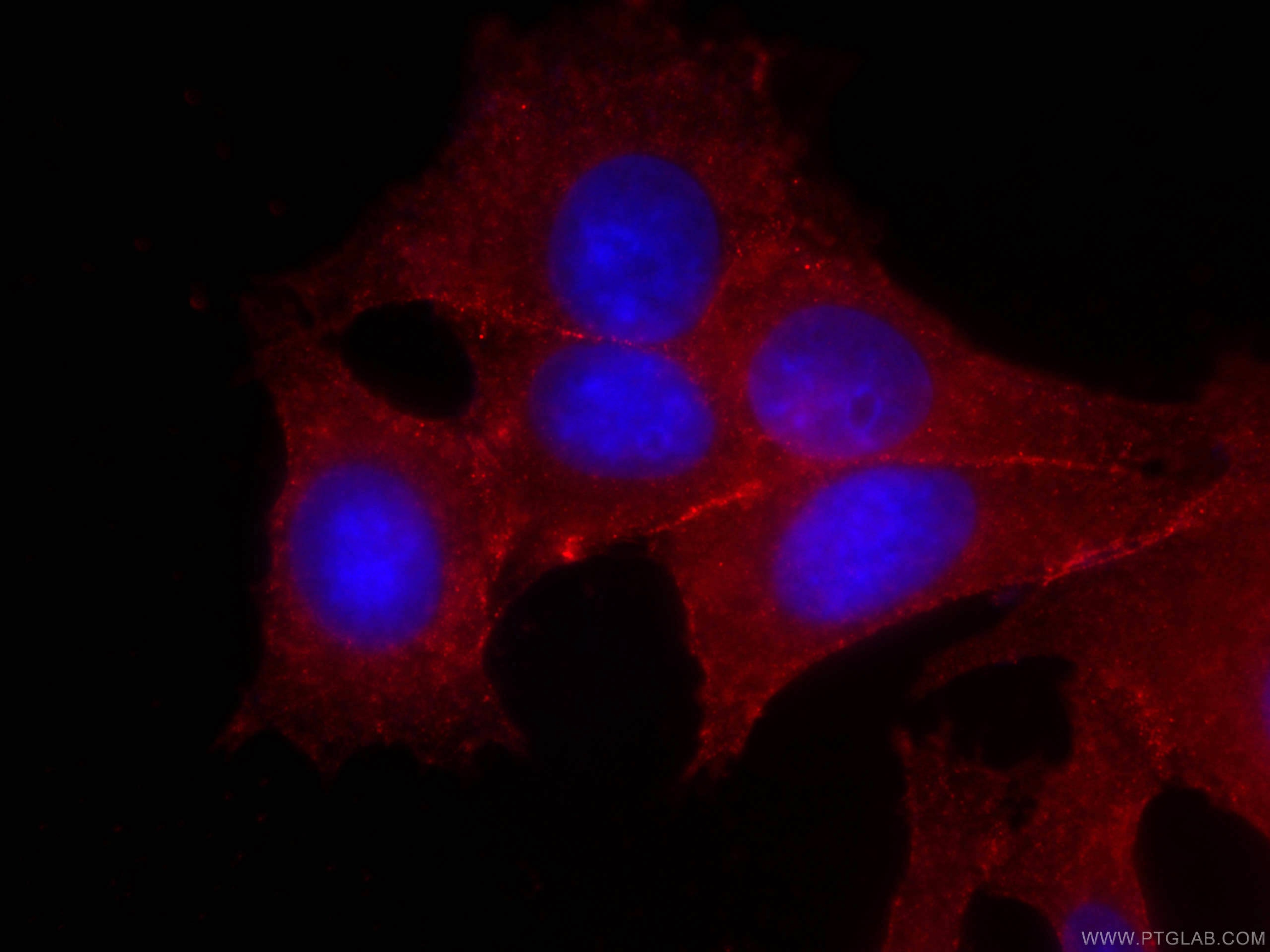 Immunofluorescence (IF) / fluorescent staining of MCF-7 cells using CoraLite®594-conjugated p120 Catenin Monoclonal an (CL594-66208)