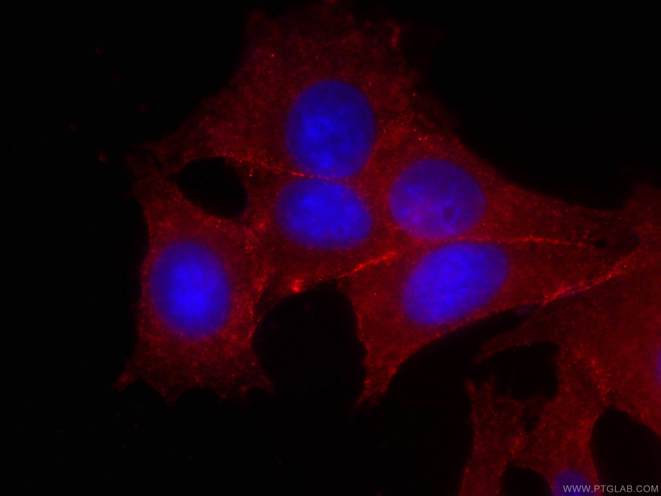 IF Staining of MCF-7 using CL594-66208