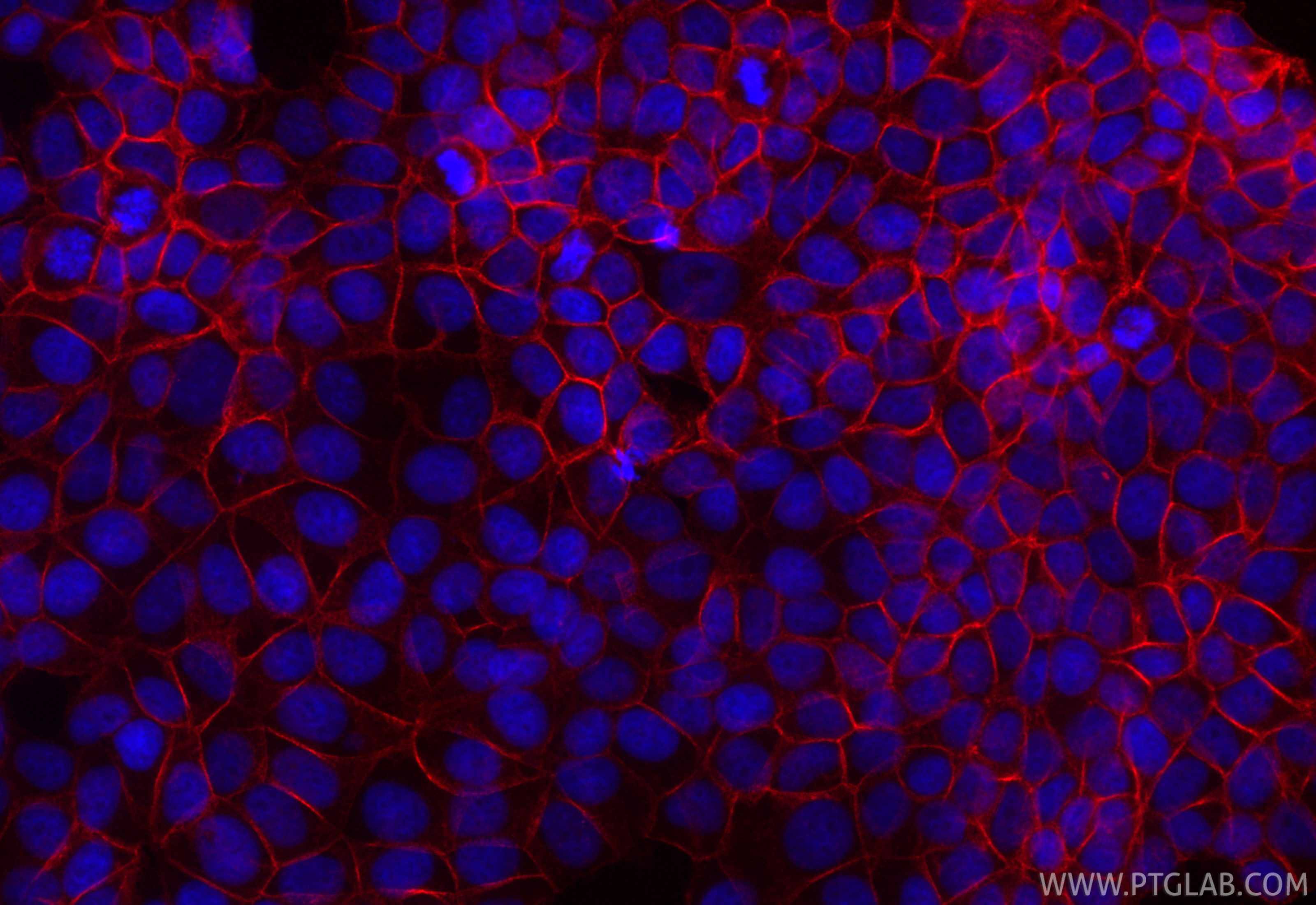 Immunofluorescence (IF) / fluorescent staining of MCF-7 cells using CoraLite®594-conjugated p120 Catenin Monoclonal an (CL594-66208)
