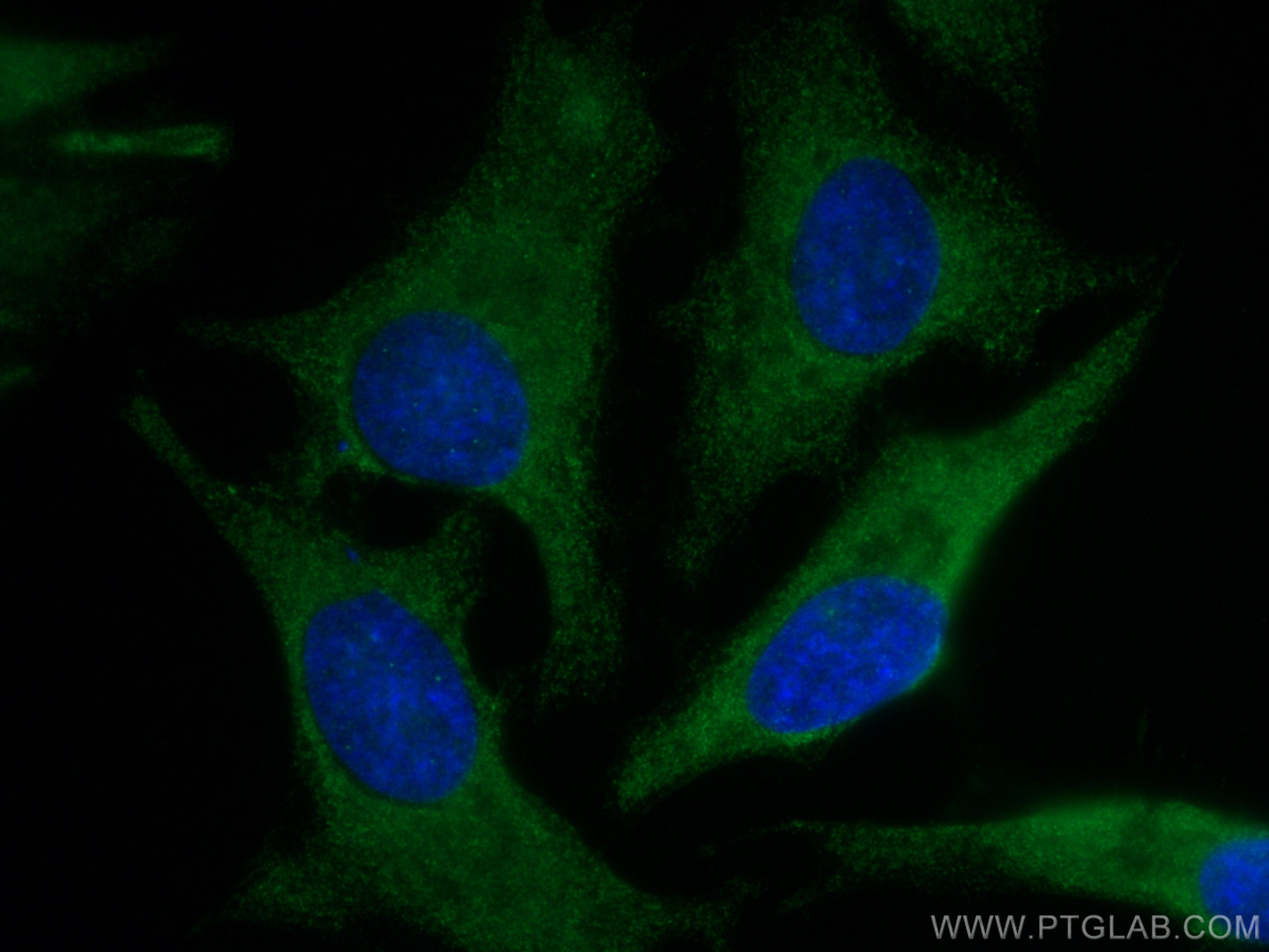 Immunofluorescence (IF) / fluorescent staining of HeLa cells using CoraLite® Plus 488-conjugated p130Cas / BCAR1 Poly (CL488-16815)