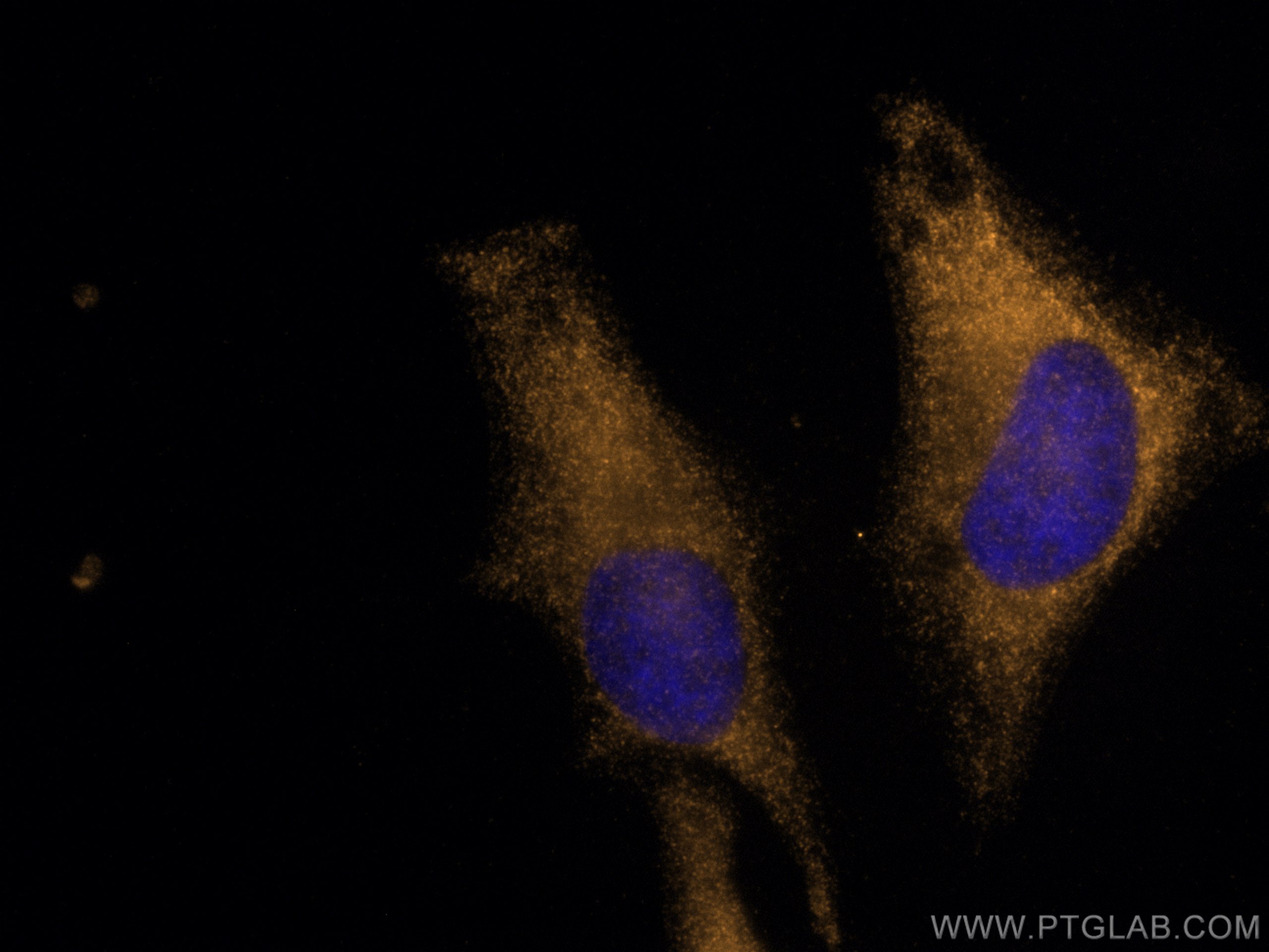 Immunofluorescence (IF) / fluorescent staining of HeLa cells using CoraLite®555-conjugated p130Cas / BCAR1 Polyclonal (CL555-16815)