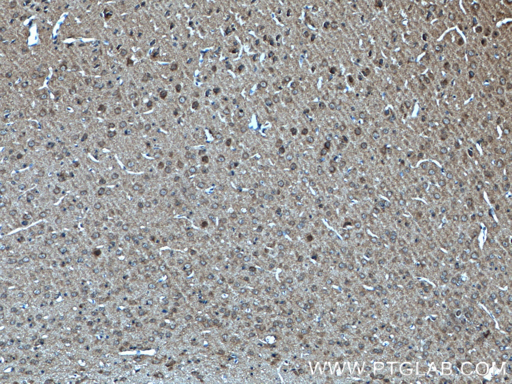 Immunohistochemistry (IHC) staining of mouse brain tissue using SNIP/p140Cap Polyclonal antibody (55362-1-AP)