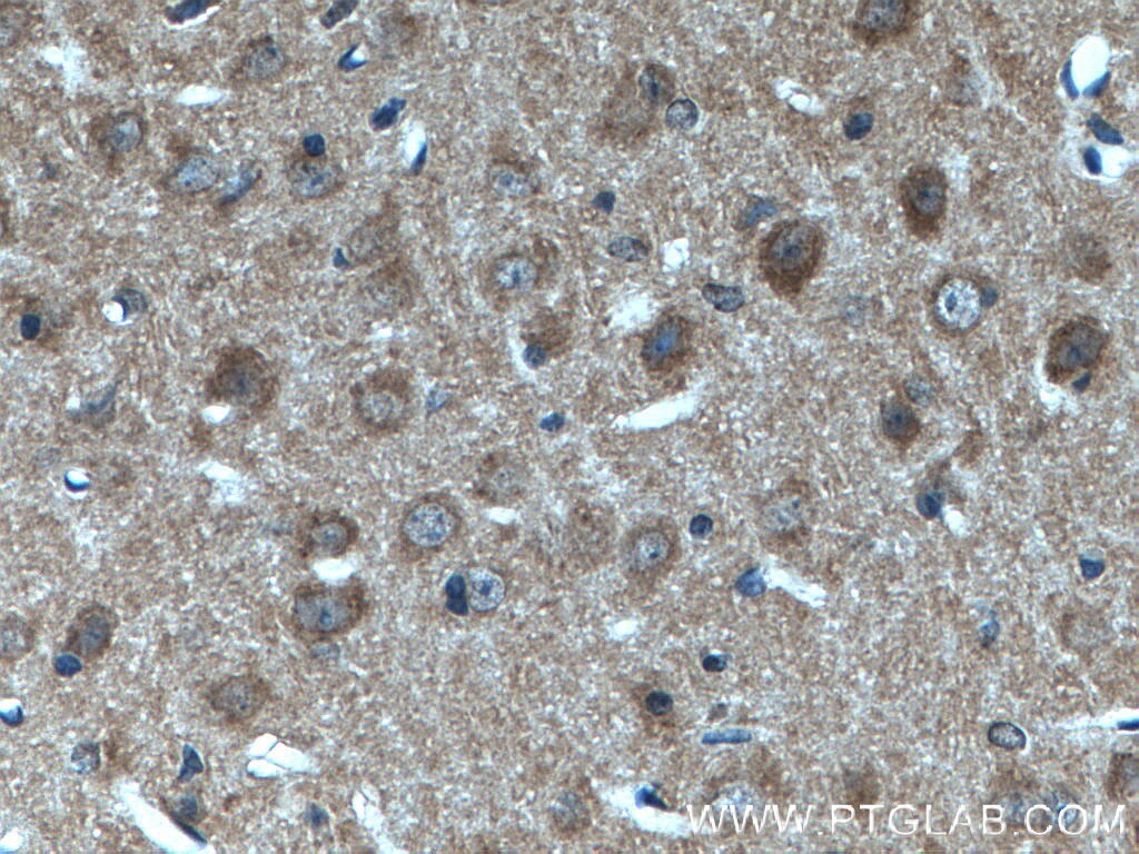 Immunohistochemistry (IHC) staining of mouse brain tissue using SNIP/p140Cap Polyclonal antibody (55362-1-AP)